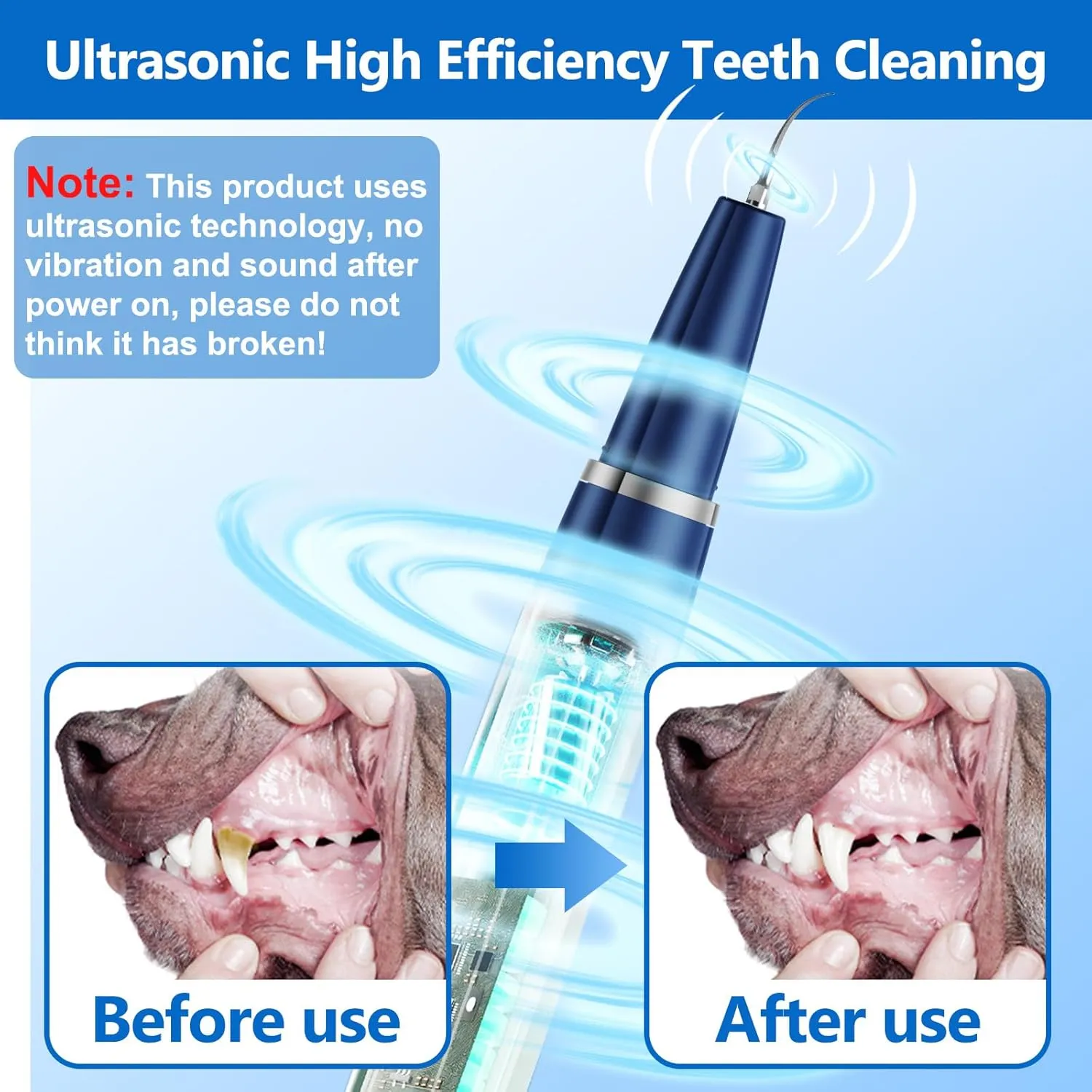 Dog Plaque Remover for Teeth,Pet Ultrasonic Tooth Cleaner,Teeth Cleaning Kit -Tartar Remover for Teeth Stains for Dogs and Cats (Blue)